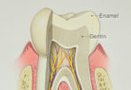 Difference Between Enamel and Dentin