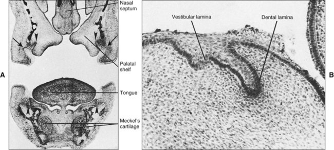 Difference Between Dental Lamina and Vestibular Lamina