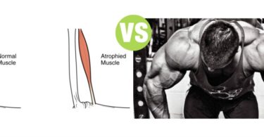 Difference Between Atrophy and Hypertrophy
