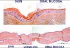 Difference Between Oral Mucosa and Skin
